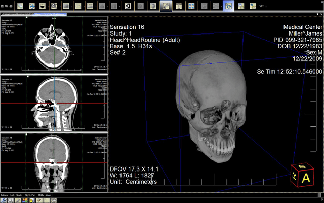 Schermata di LEADTOOLS Medical Suite SDK