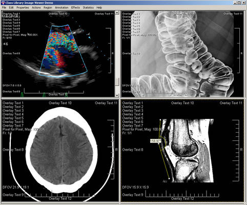 <strong>Display DICOM studies and series in one powerful viewer.</strong><br /><br />
