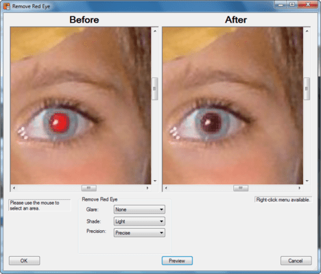 Screenshot of ImagXpress Professional ActiveX