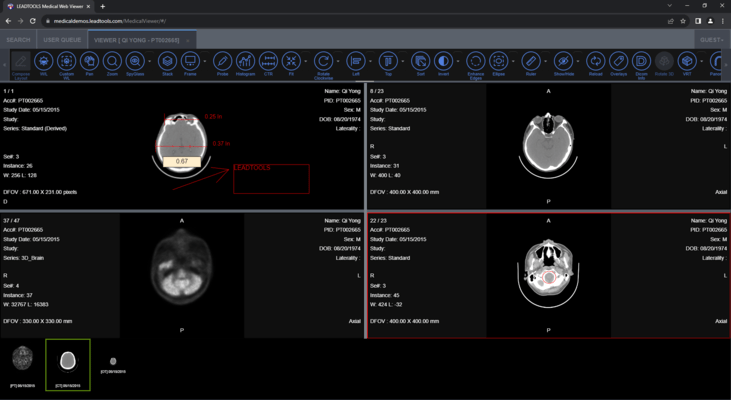 View and Annotate DICOM Images