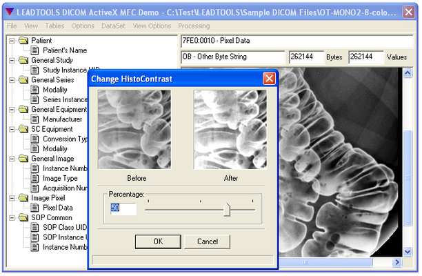Histo-Contrast Histo-Contrast
