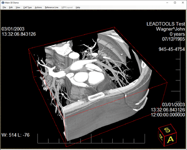 LEADTOOLS v19 Medical Imaging SDKがアップデートされました