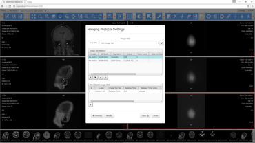 LEADTOOLS Medical Imaging Suite v19 (March 2017 Release) LEADTOOLS Medical Imaging Suite v19 (March 2017 Release)