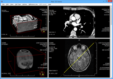 LEADTOOLS Medical Imaging（日本語版）19.0J SP3