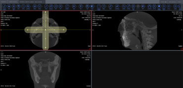 LEADTOOLS Medical Suite SDK v22 LEADTOOLS Medical Suite SDK v22