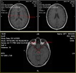 Provide advanced collaboration tools with DICOM Annotations.