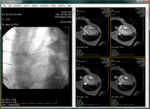 Medical Image Viewer Control