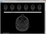 New LEADTOOLS HTML5 Medical Viewer