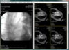 LEADTOOLS PACS Imaging SDK V20 (March 2019 release)