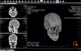 LEADTOOLS Medical Imaging Suite V20 (March 2019 release)