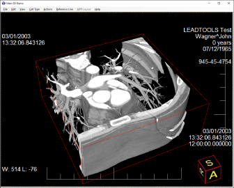 LEADTOOLS v19 Medical Imaging SDKがアップデートされました のスクリーン ショット